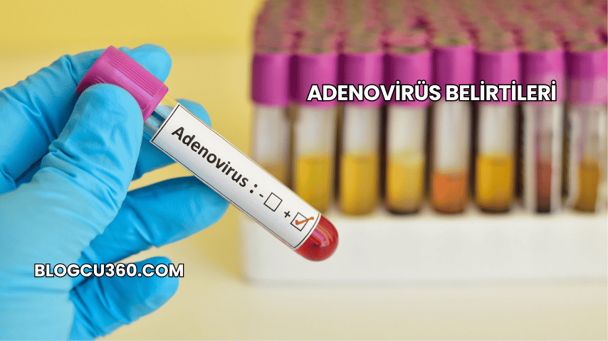 Adenovirüs Belirtileri