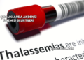 Çocuklarda Akdeniz Anemisi Belirtileri