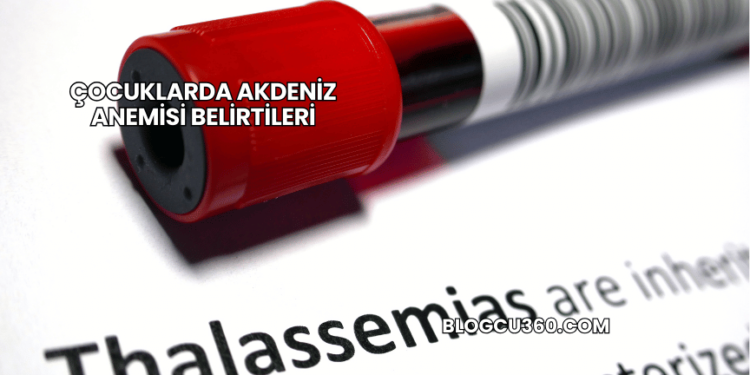 Çocuklarda Akdeniz Anemisi Belirtileri