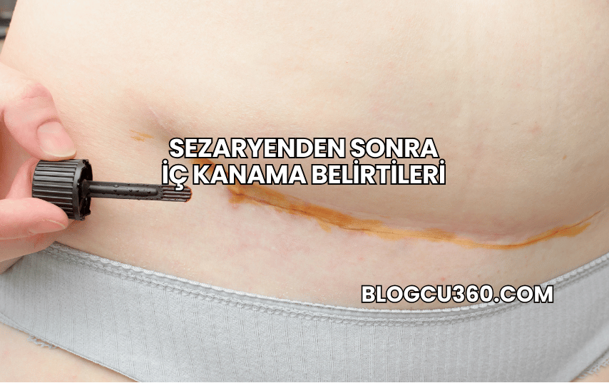 Sezaryenden Sonra İç Kanama Belirtileri