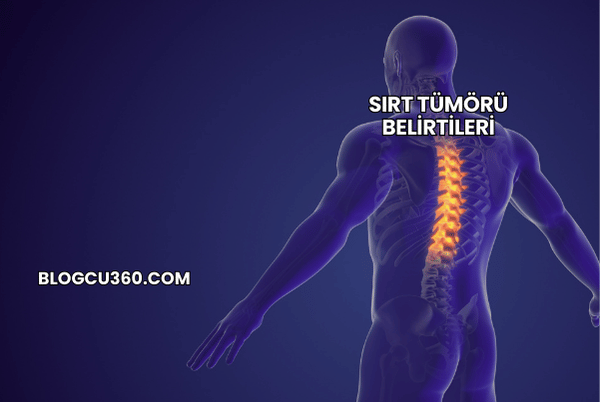 Sırt Tümörü Belirtileri