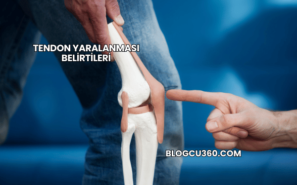 Tendon Yaralanması Belirtileri
