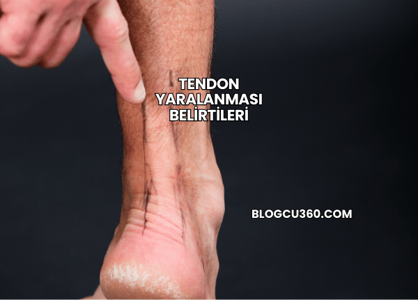 Tendon Yaralanması Belirtileri
