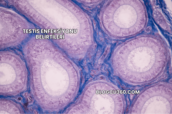 Testis Enfeksiyonu Belirtileri