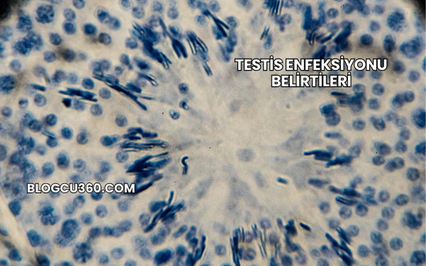 Testis Enfeksiyonu Belirtileri