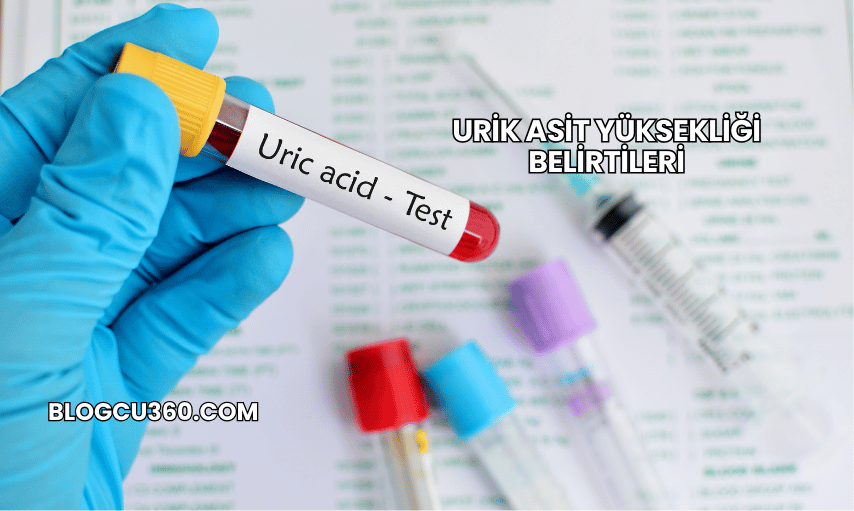Urik Asit Yüksekliği Belirtileri