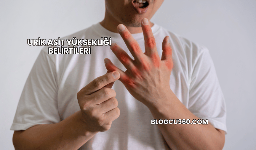 Urik Asit Yüksekliği Belirtileri