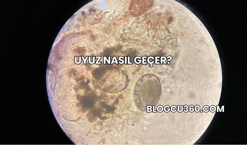 Uyuz Nasıl Geçer?