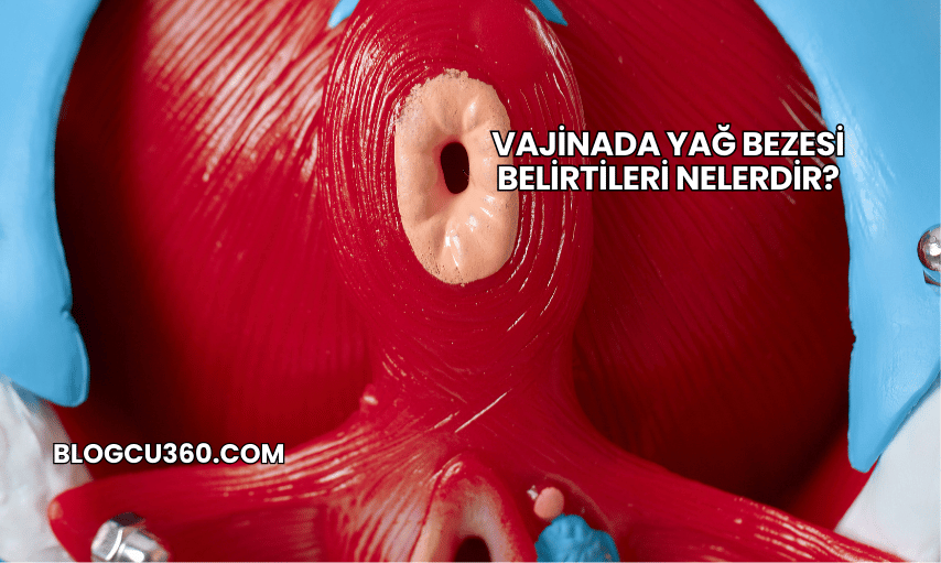 Vajinada Yağ Bezesi Belirtileri Nelerdir?