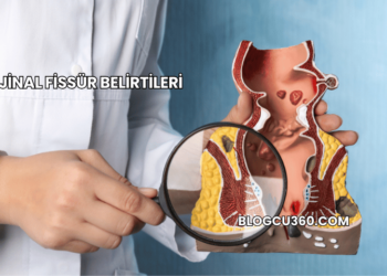 Vajinal Fissür Belirtileri