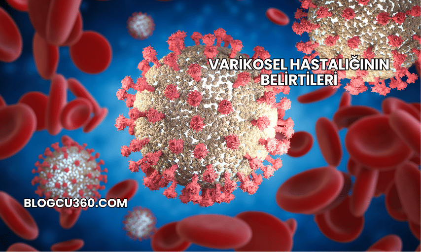 Varikosel Hastalığının Belirtileri