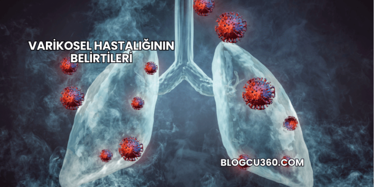 Varikosel Hastalığının Belirtileri