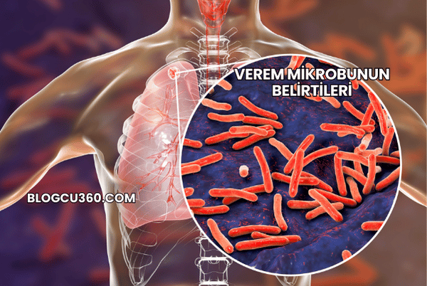 Verem Mikrobunun Belirtileri