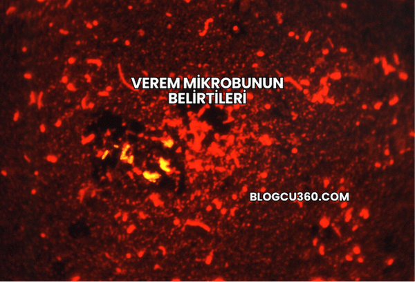 Verem Mikrobunun Belirtileri