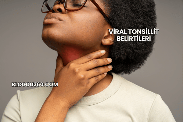 Viral Tonsillit Belirtileri