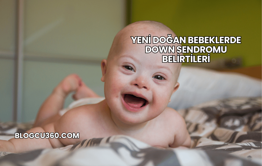 Yeni Doğan Bebeklerde Down Sendromu Belirtileri