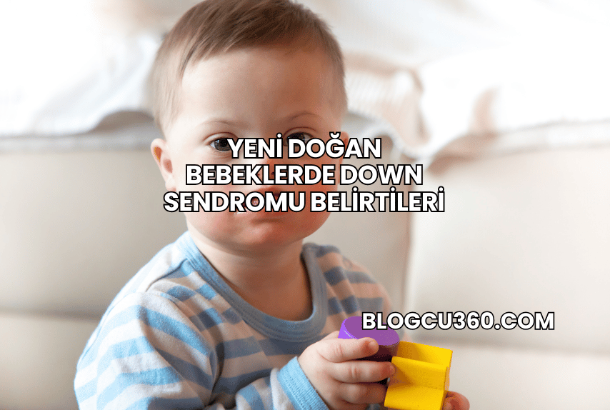 Yeni Doğan Bebeklerde Down Sendromu Belirtileri
