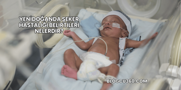 Yenidoğanda Şeker Hastalığı Belirtileri Nelerdir?