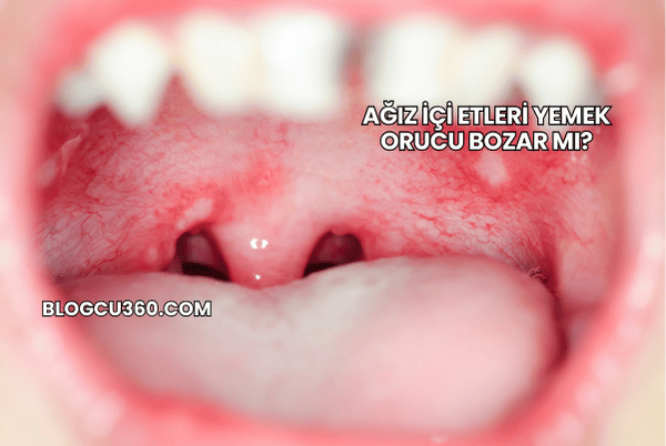 Ağız İçi Etleri Yemek Orucu Bozar mı?