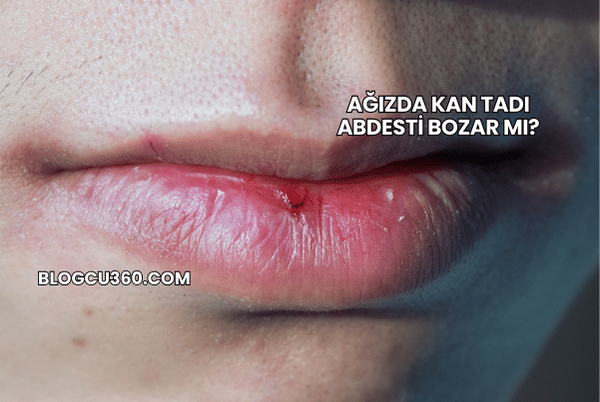 Ağızda Kan Tadı Abdesti Bozar mı?