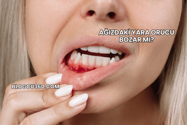 Ağızdaki Yara Orucu Bozar mı?