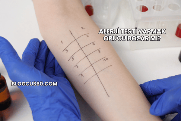 Alerji Testi Yapmak Orucu Bozar mı?