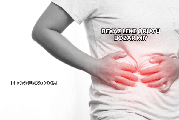 Beyaz Leke Orucu Bozar mı?