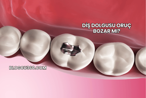 Diş Dolgusu Oruç Bozar mı?