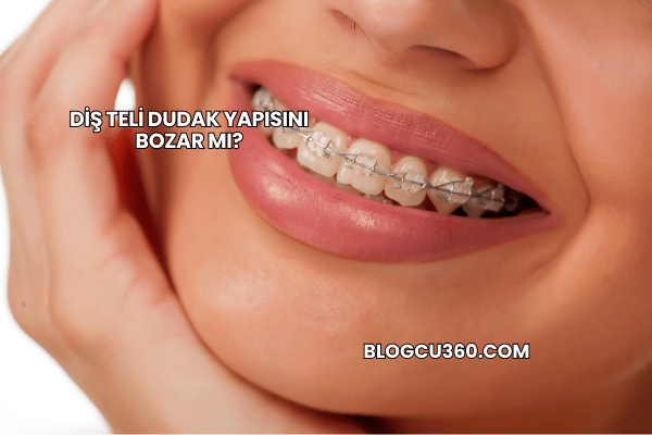 Diş Teli Dudak Yapısını Bozar mı?