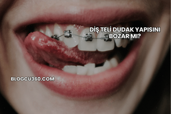 Diş Teli Dudak Yapısını Bozar mı?