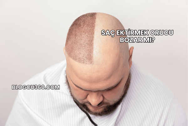 Saç Ektirmek Orucu Bozar mı?