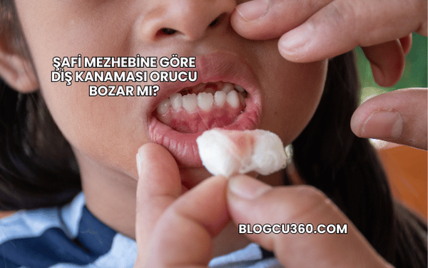 Şafi Mezhebine Göre Diş Kanaması Orucu Bozar mı?