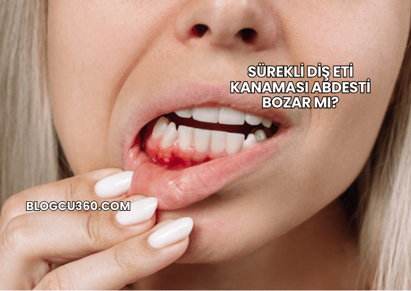 Sürekli Diş Eti Kanaması Abdesti Bozar mı?