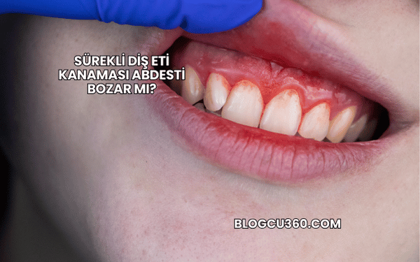 Sürekli Diş Eti Kanaması Abdesti Bozar mı?