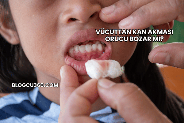 Vücuttan Kan Akması Orucu Bozar mı?