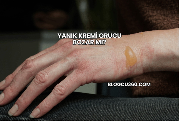 Yanık Kremi Orucu Bozar mı?