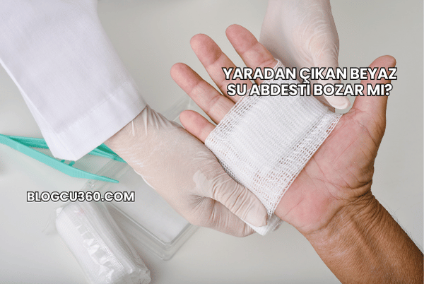 Yaradan Çıkan Beyaz Su Abdesti Bozar mı?