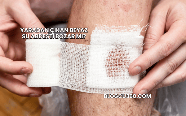 Yaradan Çıkan Beyaz Su Abdesti Bozar mı?