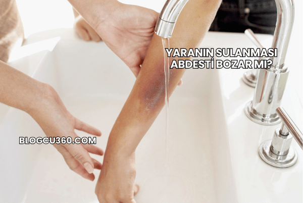Yaranın Sulanması Abdesti Bozar mı?