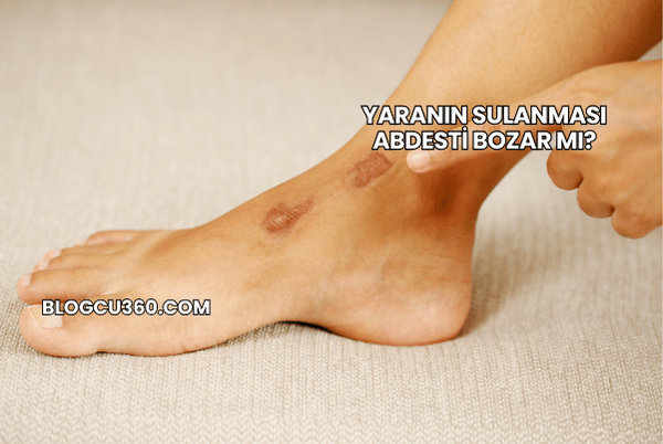 Yaranın Sulanması Abdesti Bozar mı?