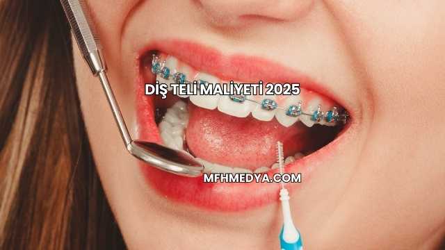 Diş Teli Maliyeti 2025